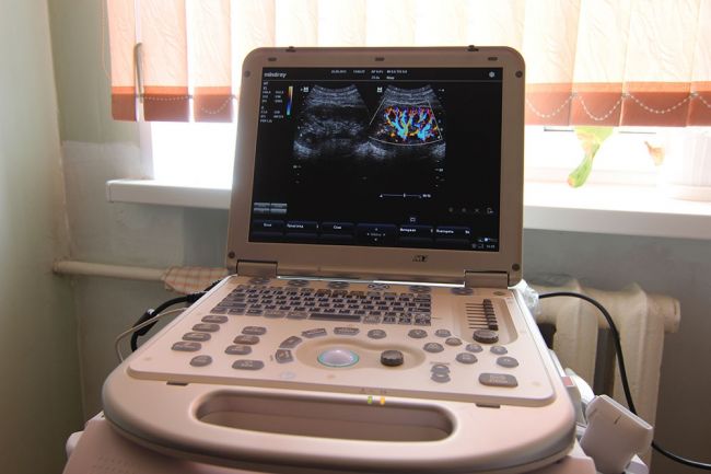УЗИ-аппараты экспертного класса доставят в Пермь
