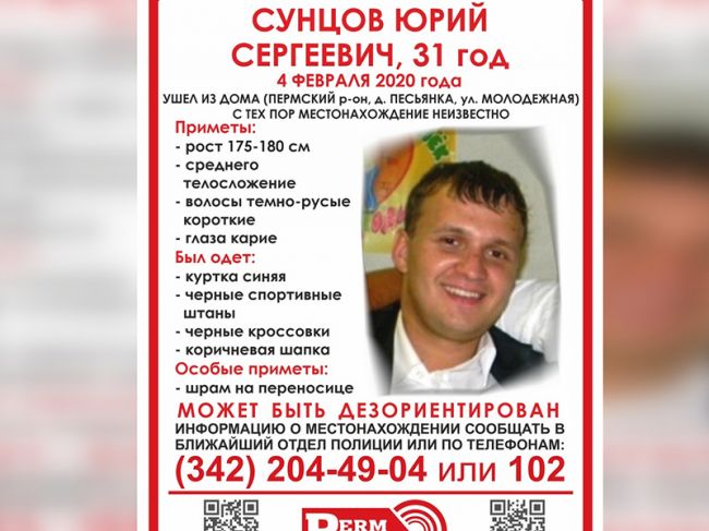 Под Пермью пропал мужчина со шрамом на лице