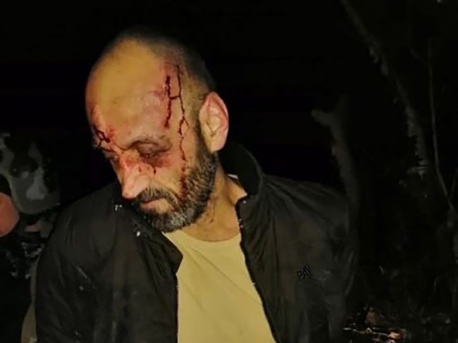 Гайвинский стрелок, убивший прохожую, признан невменяемым